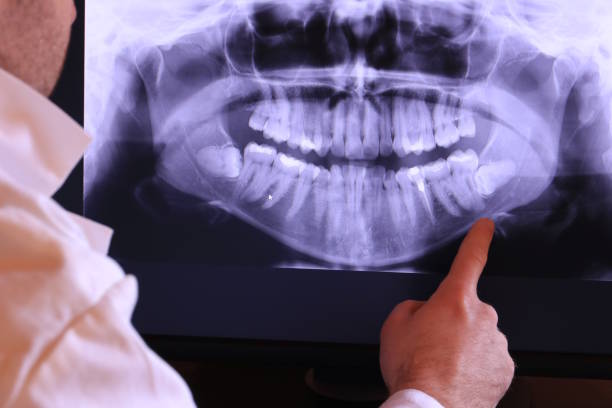 Best Weekend Emergency Dentist in El Rancho, NM