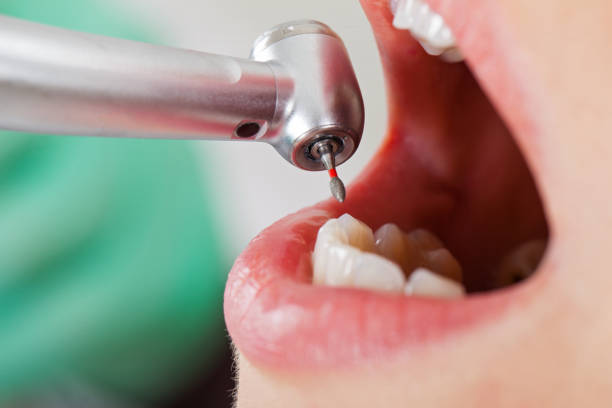 Best Emergency Dental Care for Trauma or Injury in El Rancho, NM